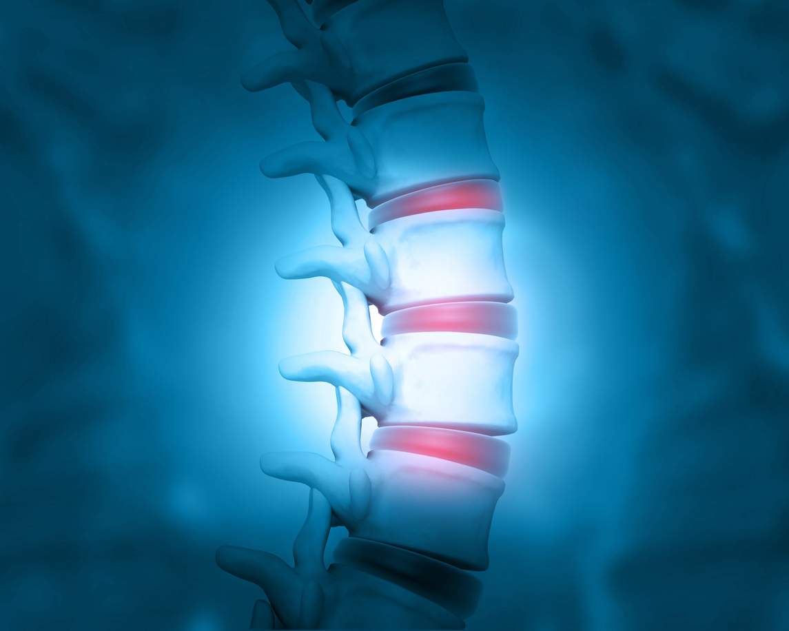 Chronic Pain